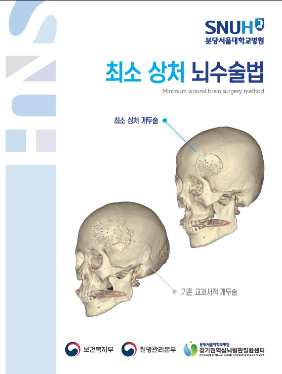 최소상처 뇌수술법.jpg